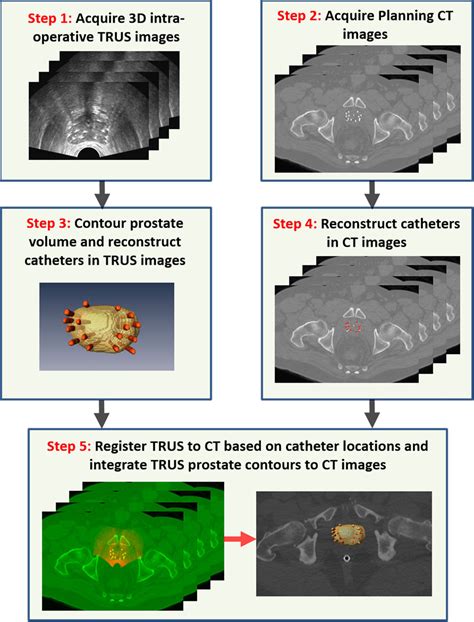 Figure From Improved Prostate Delineation In Prostate Hdr