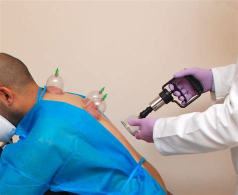 titik bekam  dilarang beserta manfaatnya  kesehatan