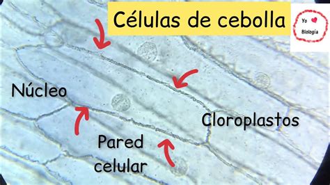 Células de cebolla al microscopio BiologíayEcología