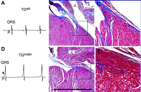 Activated Protein Kinase In The Heart Circulation Research