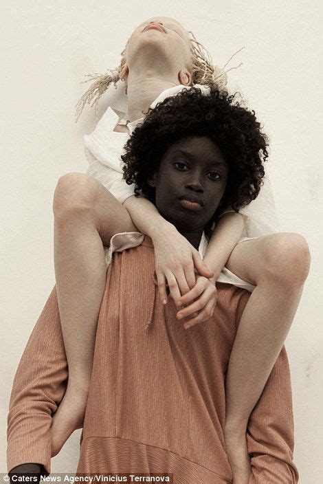 Albino Twins From São Paulo Become Models Albino Model Black Photography Albino Twins