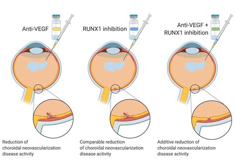 New Therapeutic Approach May Help Treat Age Related Macular