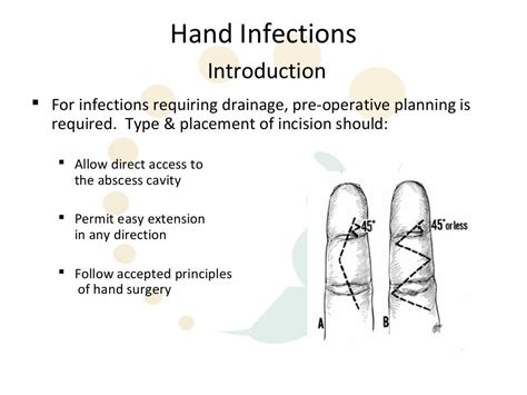 Hand infections