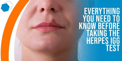 Is Herpes A Deadly Infection Everything You Need To Know