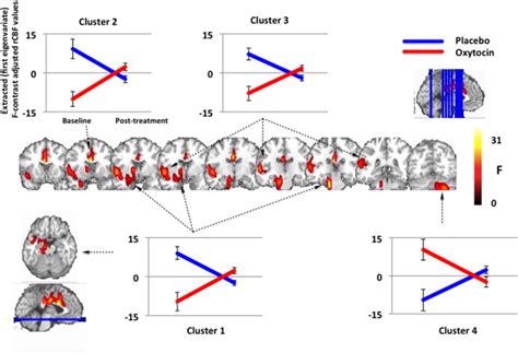 Statistical Parametric Maps For The Four Clusters Showing A Significant