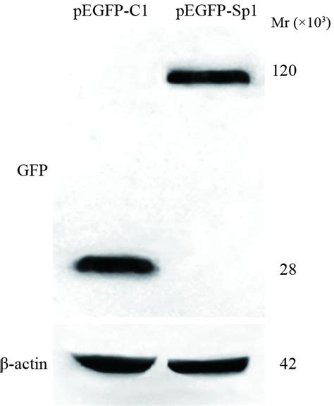 Gfp Sp