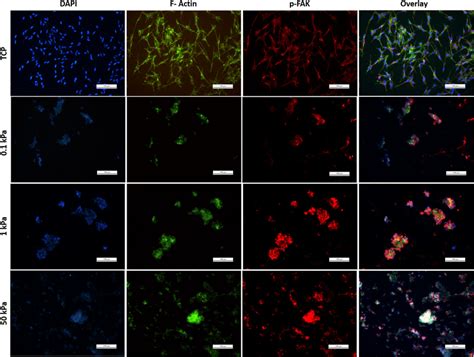 Fluorescence Microscopy Images Of Shsy Y Neuroblastoma Cells