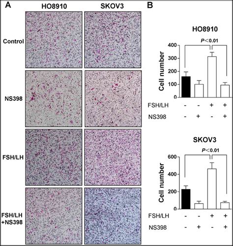 Gonadotropins Promote Human Ovarian Cancer Cell Migration And Invasion