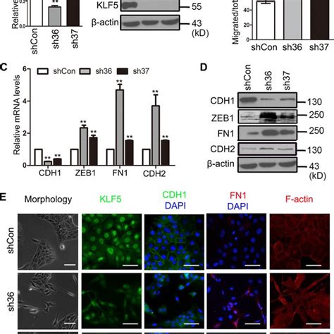 RNA Interference Mediated Knockdown Of KLF5 Induces EMT In MCF 10A