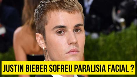 Justin Bieber Mostra Recupera O Impressionante Ap S Paralisia Facial