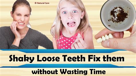 Shaky Loose Teeth Fix Them Without Wasting Time Youtube