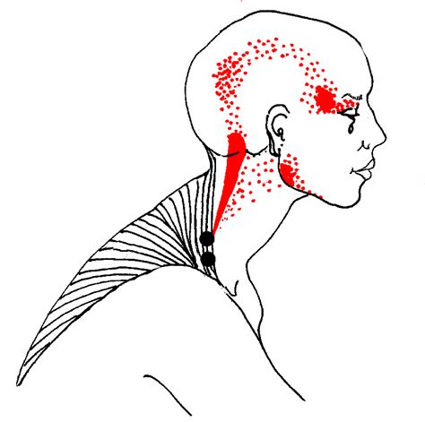 National Association Of Myofascial Trigger Point Therapists