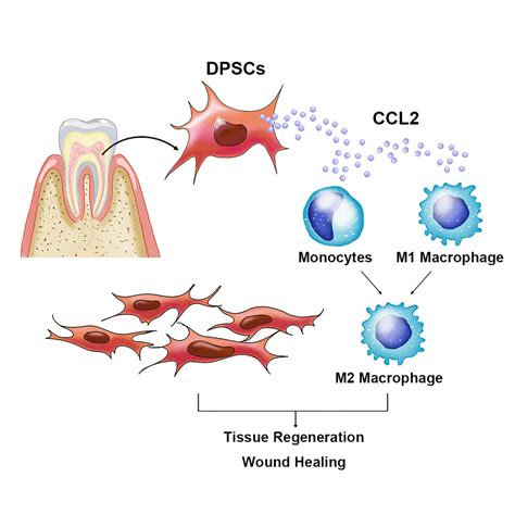 Dental Pulp Stem Cells Accelerate Wound Healing Through CCL2 Induced M2