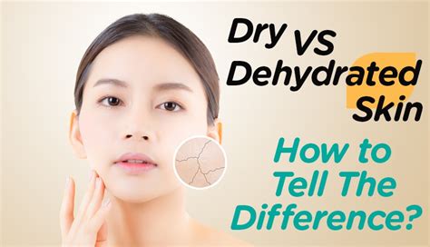 Dry Vs Dehydrated Skin How To Tell The Difference Watsons Singapore