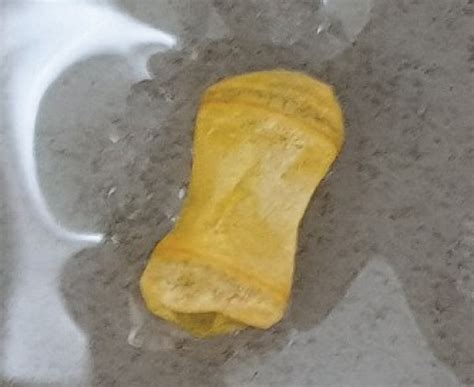 Identification Of Passed Patency Capsule A B Intact And C D