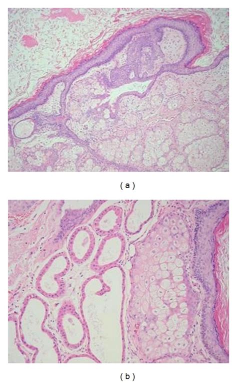 A Hematoxylin And Eosin Stain X100 Magnification Section Showing