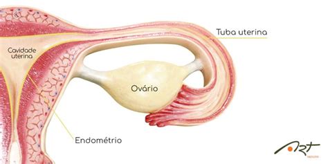 Obstrução das tubas uterinas e infertilidade Art Medicina Reprodutiva