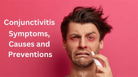 Conjunctivitis Symptoms Causes Preventions