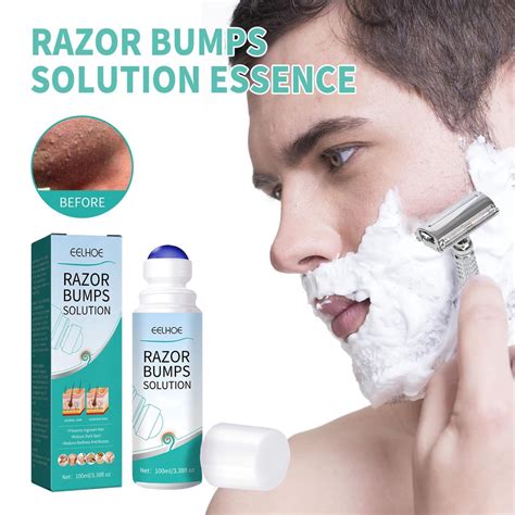 Razor Bump And Ingrown Hairs Serum After Shave Solution Roll On For Ingrown Hairs Razor Burns