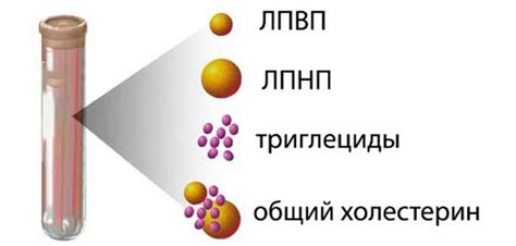 ЛИПИДОГРАММА Липидограмма, также известная как липидный профиль или ...