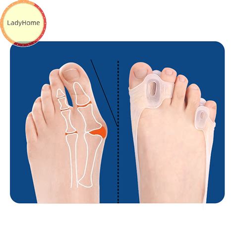 LadyHome 1Pair Silicone Bunion Corrector Toe Separator Gel Forefoot