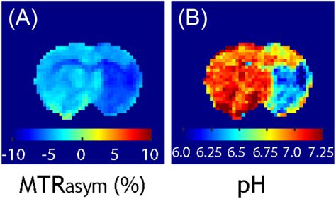 Chemical Exchange Saturation Transfer Mri Nmr In Biomedicine Vol No