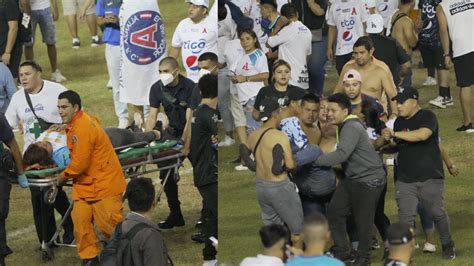 La Mayor A De Pacientes Que Fueron Atendidos Luego De La Estampida