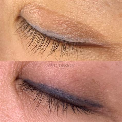 Remove Permanent Eyeliner Benefits Side Effects And Cost