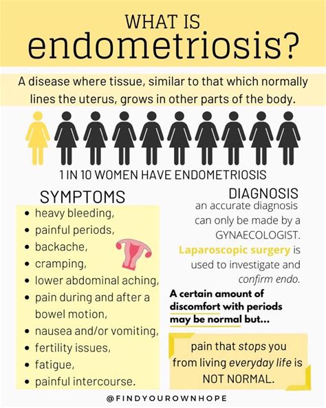 Endo Belly Series Part 2l Digestive Bloat Artofit