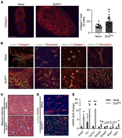 Jci Lymph Node Fibroblastic Reticular Cells Deposit Fibrosis