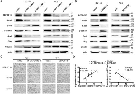 Depdc B Promotes Emt To Induce Metastasis In Pca A And B