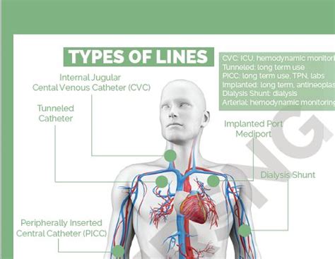 Central Venous Catheters (Central Lines) Cheat Sheet - Medical eStudy ...