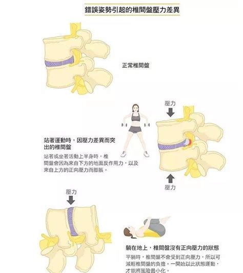 預防和恢復腰間盤突出從好的姿式開始 每日頭條