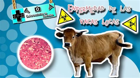 Encefalopatía espongiforme bovina Enfermedad de las Vacas locas