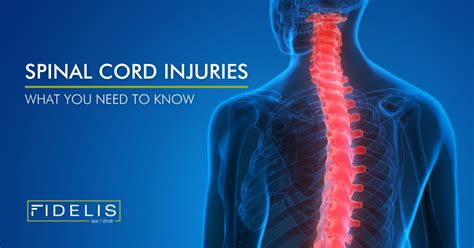 spinal cord injuries fidelis personal injury lawyers
