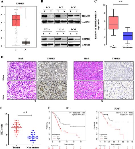 Trim Expression Was Upregulated And Correlated With Survival In