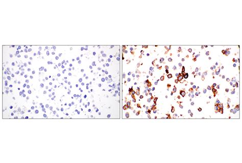 Cd E V V Rabbit Mab Cell Signaling Technology