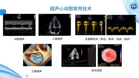 零基础入门心脏超声看完这套课程就会了 严道医声网