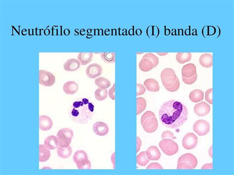 Neutrófilo segmentado I banda D marcia gomez uDocz