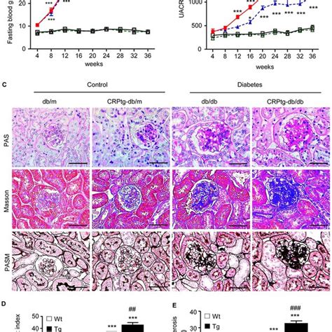 Crptg Db Db Mice Develop More Severe Diabetic Renal Functional And