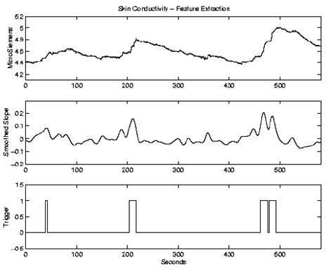 Skin Conductance