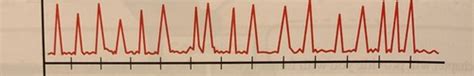 Phys II Repro Reproductive Cyclicity 7 Follicular Phase 8 And