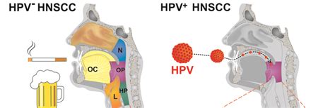 Head And Neck Squamous Cell Carcinoma HNSCC BioGraphix