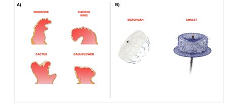 A Different Anatomical Morphologies Of The Left Atrial Appendage B