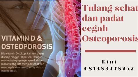 Tulang Sehat Dan Padat Cegah Osteoporosis Rini 081383778752 Youtube