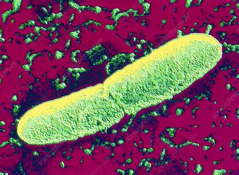 Yersinia Pestis Plague Bacteria Stock Image B220 0768 Science