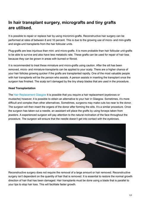 In Hair Transplant Surgery Micrografts And Tiny Grafts Are Utilised By Este Medical Group Issuu