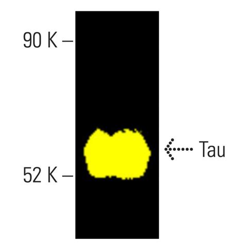 Tau抗体 TAU 5 SCBT Santa Cruz Biotechnology