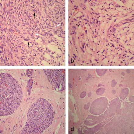 Histopathological Findings Of Lesion A Photomicrographs Showed That