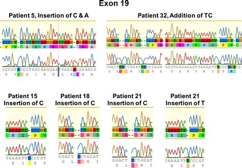 Egfr Sequencing Of Exon Insertion Of Cytosine And Adenine Occurred